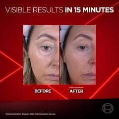 L'OREAL PARIS Revitalift Lazer Eyebag Instant Eraser Göz Altı Torba Görünümüne Karşı Etkili Göz Kremi 15ml