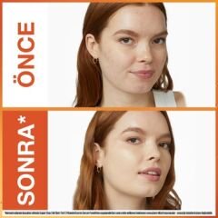 Maybelline New York Super Stay Skin Tint Fondöten 03